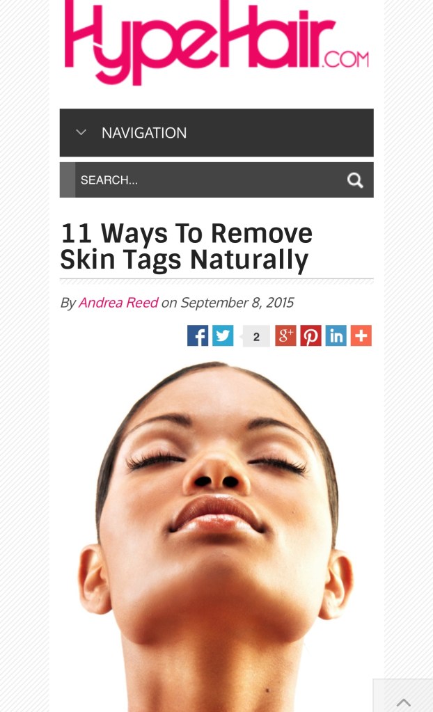 remove skin tags naturally